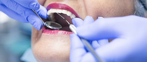 Best Knocked-Out Tooth (Avulsed Tooth) Treatment in Harwich Center, MA